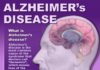 Medical infographic : Medical infographic : #Alzheimer’s disease is the most common cause of the syndrome that doctors call …