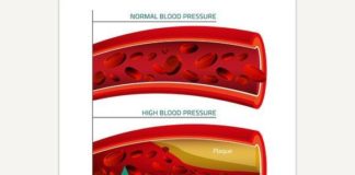 Medical infographic : Medical infographic : Blood Pressure Infographic. Medical Infographic. $3.00