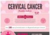 Medical infographic : Medical infographic : Cervical Cancer Infographic
