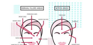 Medical infographic : Medical infographic : Infographic about Dermal Fillers. Medical Infographic. $3.00