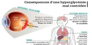 Medical infographic : Medical infographic : Les dangers du sucre et conseils pour réduire votre apport quotidien