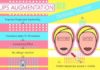 Medical infographic : Medical infographic : Lips Augmentation Poster. Medical Infographic. $3.00