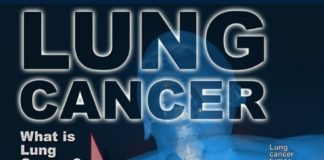 Medical infographic : Medical infographic : Medical infographic : The Lowdown on Lung Cancer Infographic