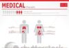 Medical infographic : Medical infographic : Medical infographic : stock vector : Medical infographics. Human body with inter…