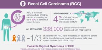 Medical infographic : Medical infographic : Renal Cell Carcinoma (RCC) #KidneyCancer