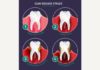 Medical infographic : Medical infographic : Teeth Vector Infographic. Medical Infographic. $3.00