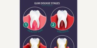 Medical infographic : Medical infographic : Teeth Vector Infographic. Medical Infographic. $3.00