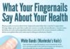 Medical infographic : Medical infographic : What Your Fingernails Say About Your Health