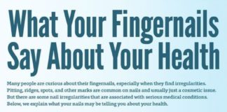 Medical infographic : Medical infographic : What Your Fingernails Say About Your Health