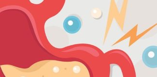 Medical infographic : Medical infographic : อาการของโรคกระเพาะอาหารและ…