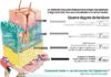 Science infographic – Grands brûlés : le défi de la peau de remplacement – #brûlés #de #défi #Gr…