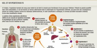 Science infographic – Medical infographic : Sel et hypertension