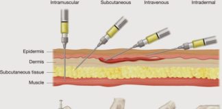 Science infographic – Medical infographic : injections parentérales infirmier angle technique