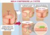 Science infographic – Mieux comprendre les causes de la cystite Regardez une vidéo sur YouTube sur la…