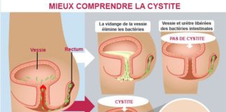 Science infographic – Mieux comprendre les causes de la cystite Regardez une vidéo sur YouTube sur la…
