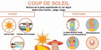 Science infographic – Notre infographie sur les coups de soleil