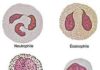 Science infographic – Science infographic – Différentes variétés de leucocytes