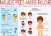 Science infographic – maladie pieds mains bouche