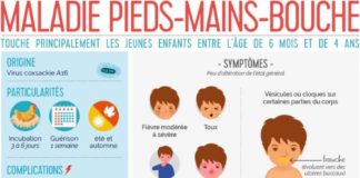 Science infographic – maladie pieds mains bouche