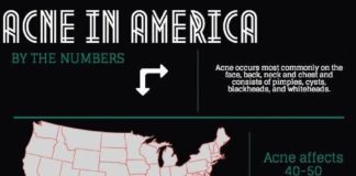 Statistics infographic : INFOGRAPHIC: Acne in America Statistics #CysticAcneHormonal #infographicsstatist…