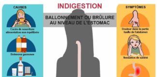 Science infographic – Indigestion : causes, symptômes & traitements | Creapharma
