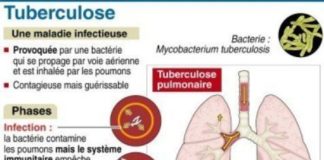 Science infographic – Science infographic – Tuberculose et antibiorésistance : des chercheurs lillois inventent un nouveau prototype de médicament
