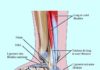 Science infographic – anatomie,ligaments,cheville,pied,tendon,fibulaire