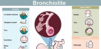 Educational infographic : La bronchiolite (ou bronchiolite du nourrisson) est une maladie virale qui est d…