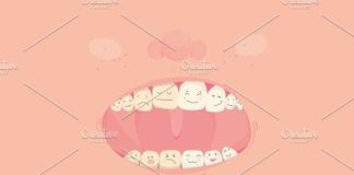 Medical infographic : Teeth whitening Before and After . Medical Infographic reviewscircle.com…