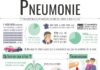 education infographic – 2017-11-infographie-pneumonie – Santé sur le net